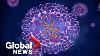 What Is Monkeypox The Symptoms How It S Spread And Risk To The Public